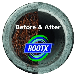 Rootx Treatment Before and After